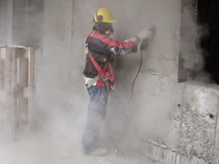 silicosis